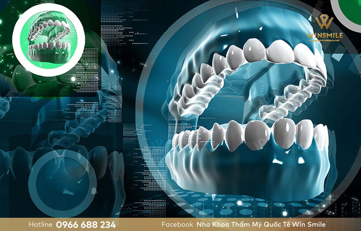 Quy trình thiết kế răng sứ DDBIO được hỗ trợ bởi công nghệ CAD/CAM hiện đại nhất hiện nay