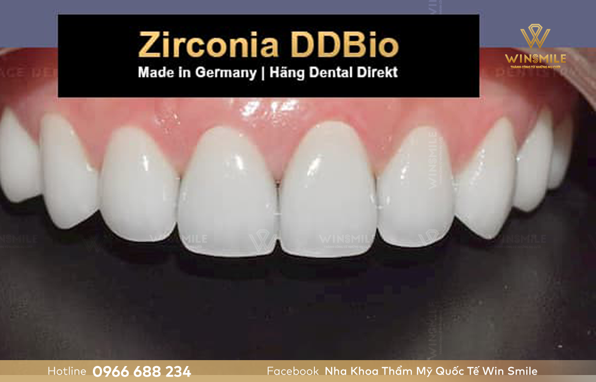 Răng sứ ddbio là sản phẩm nổi bật đến từ Đức