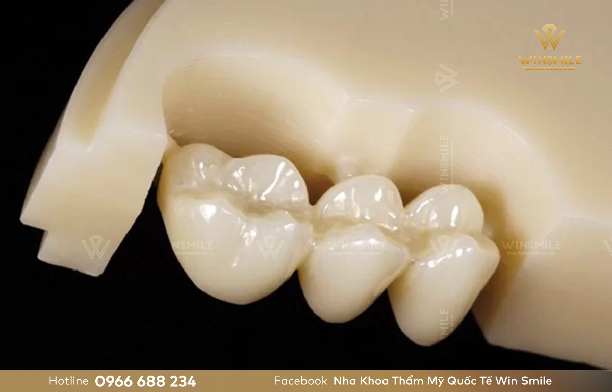 Răng sứ Katana là sản phẩm nổi bật có nguồn gốc từ Nhật Bản