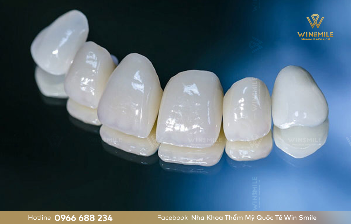 Răng sứ Lava Esthetics có độ trong mờ cao, tối ưu hóa thẩm mỹ cho phục hình nguyên khối