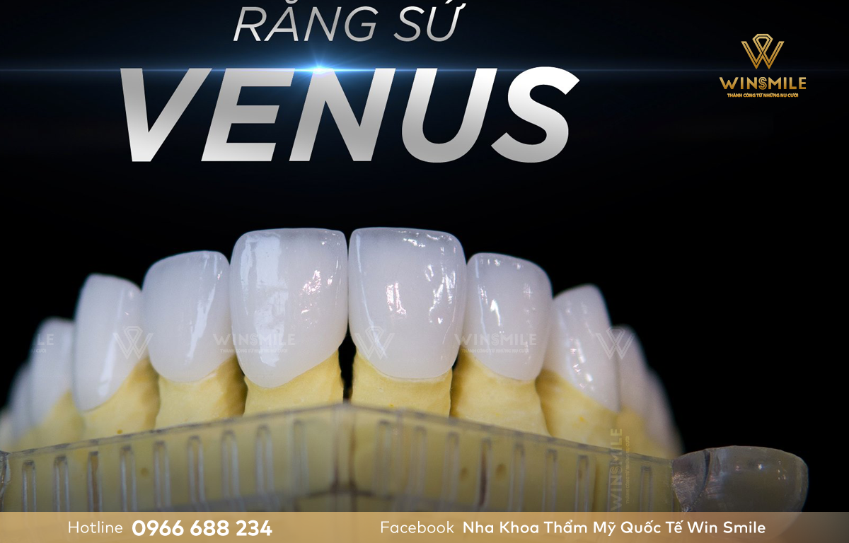 Răng sứ Venus được đánh giá là phù hợp với điều kiện kinh tế của nhiều người