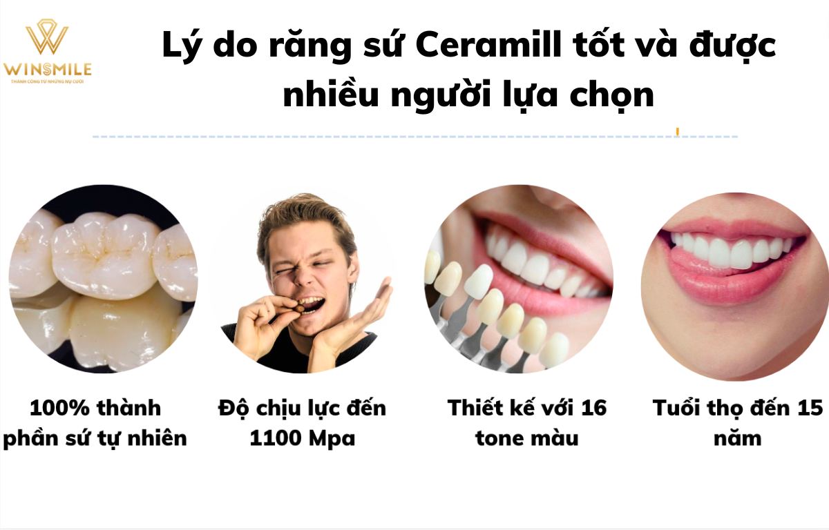 Răng sứ Ceramill là lựa chọn của nhiều người