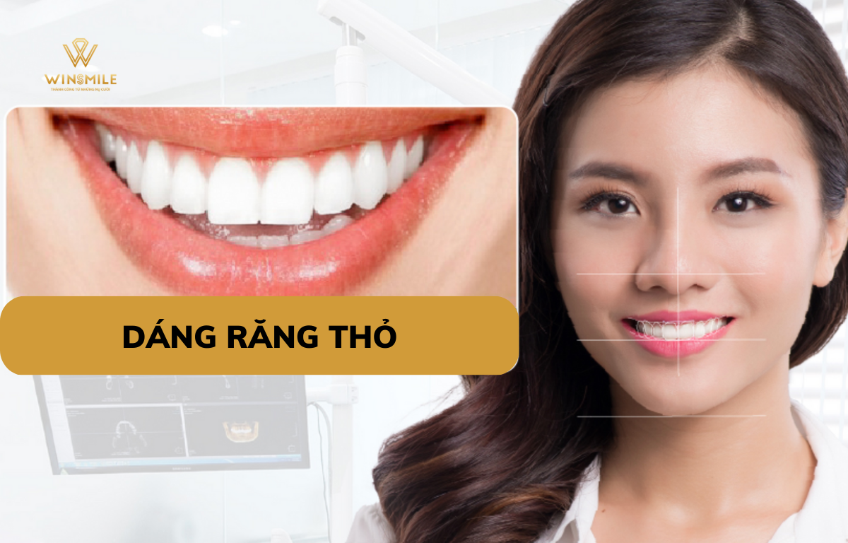 Dáng răng thỏ: Những điều bạn cần biết về thẩm mỹ và ý nghĩa