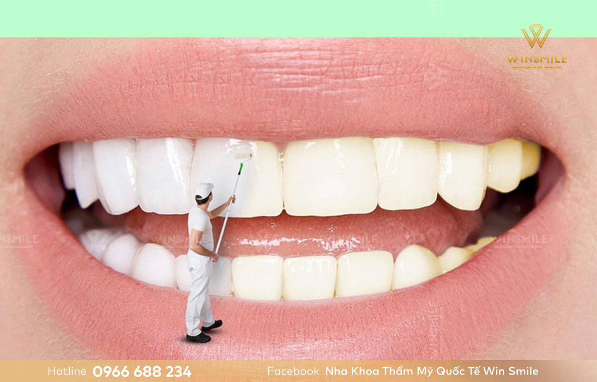 Tẩy trắng răng giúp khắc phục răng xỉn màu, ố vàng