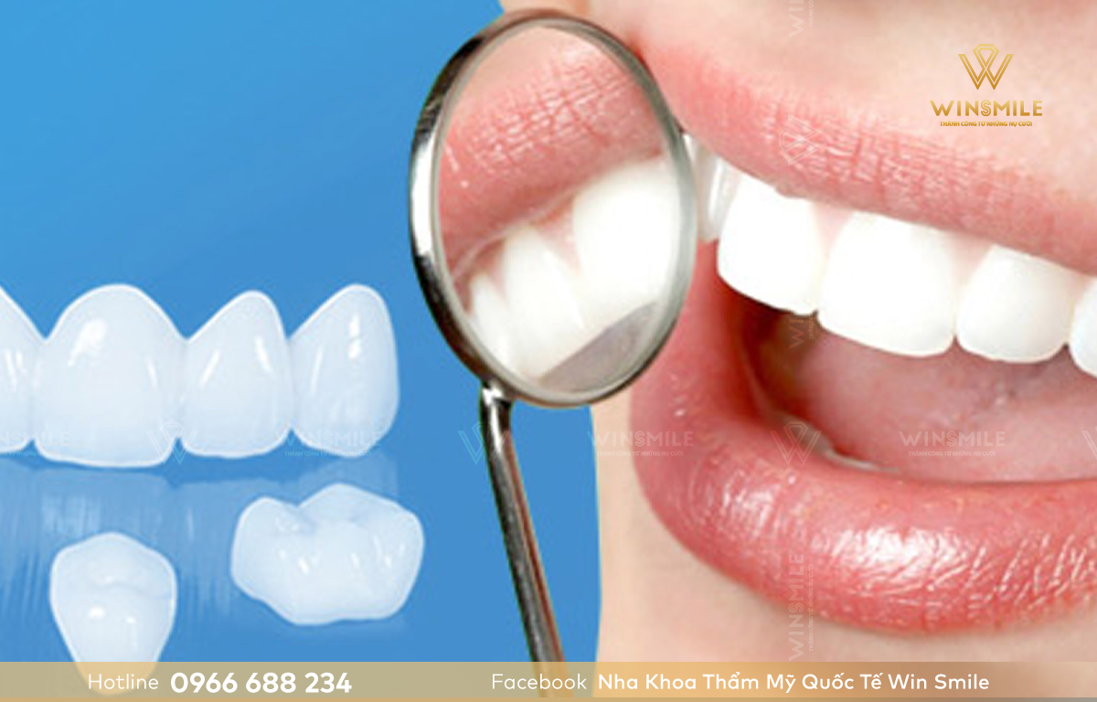 Làm răng thưa hiệu quả thẩm mỹ cao, chi phí tùy vào chất liệu sứ