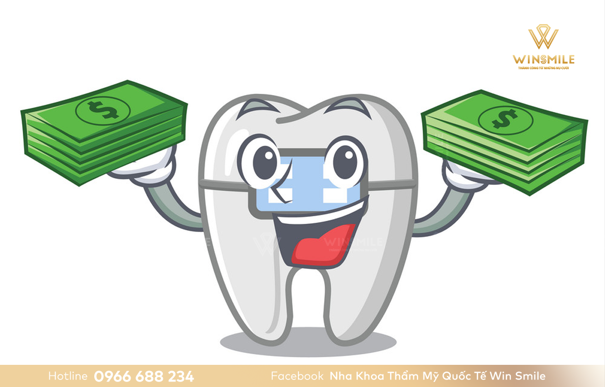 Các loại niềng răng và giá từng loại phụ thuộc vào nhiều yếu tố