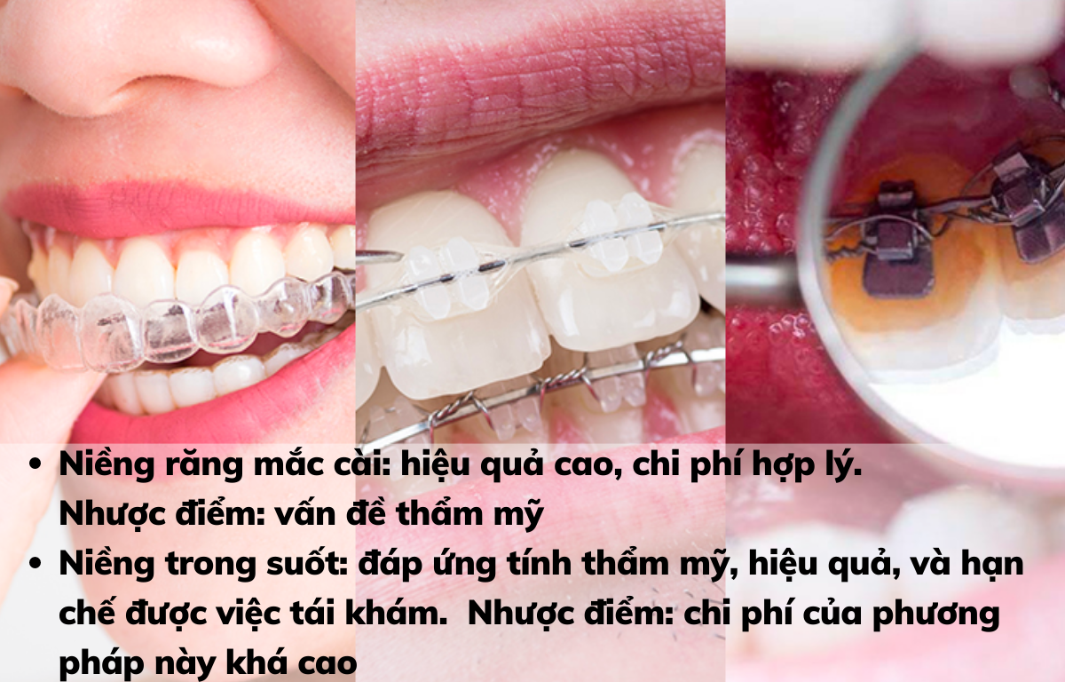 Cả niềng răng trong suốt và mắc cài đều hướng đến một hiệu quả chung