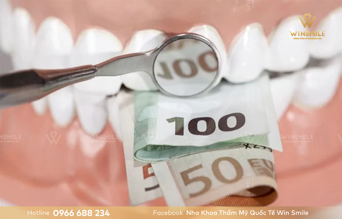 Giá trồng răng implant được tính đơn lẻ