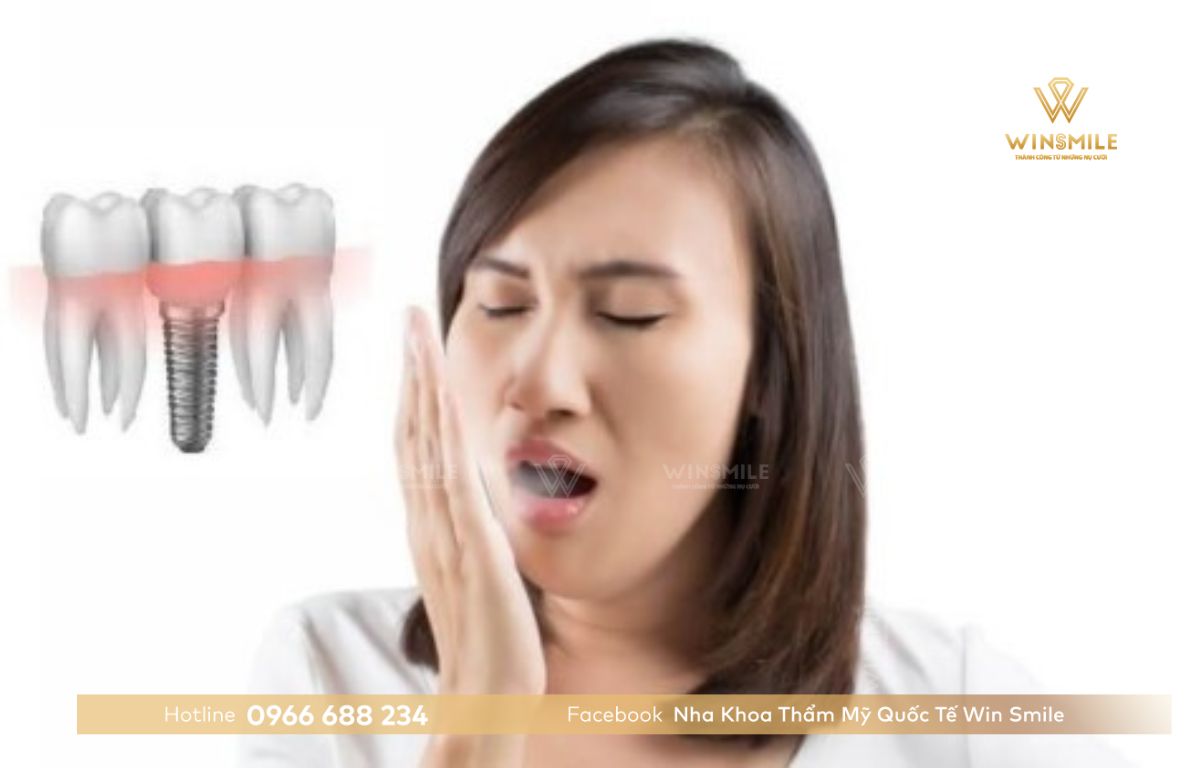 Hôi miệng sau khi trồng răng implant 