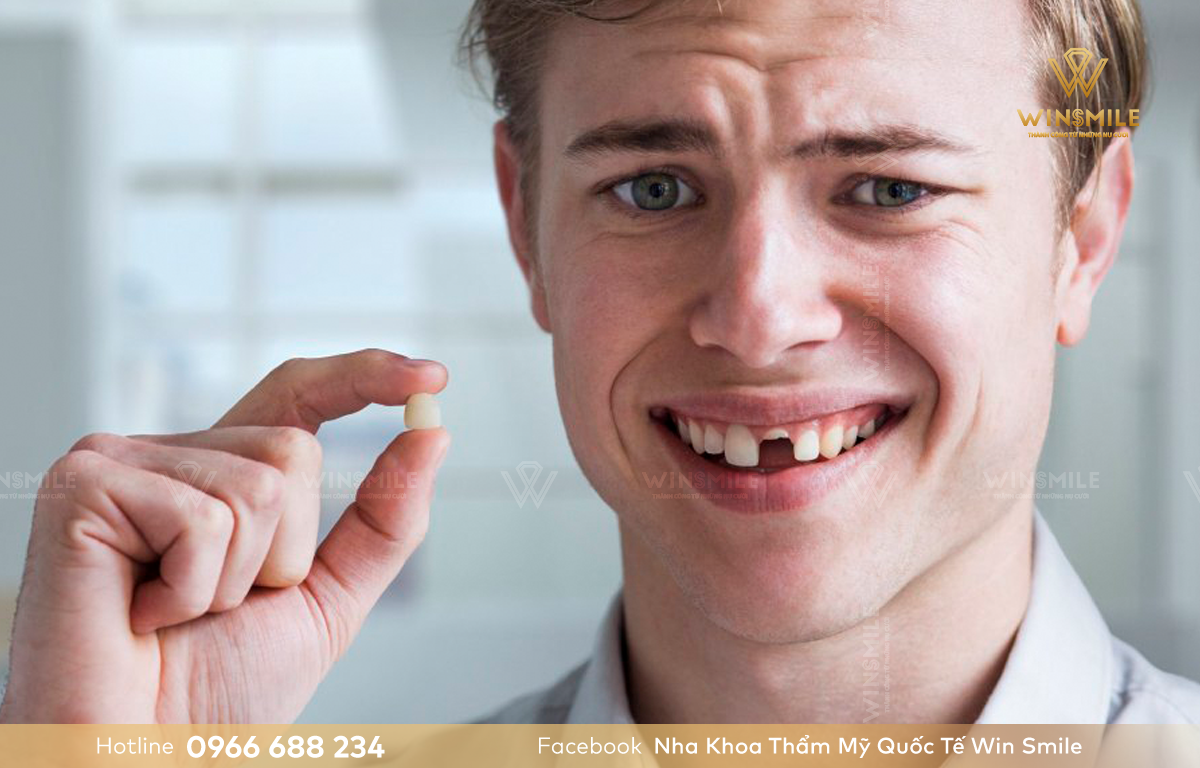 Mất 1 hoặc nhiều răng có thể áp dụng trồng răng sứ