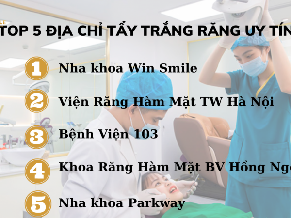 Mách bạn 4+ địa chỉ tẩy trắng răng uy tín tại Hà Nội không thể bỏ qua