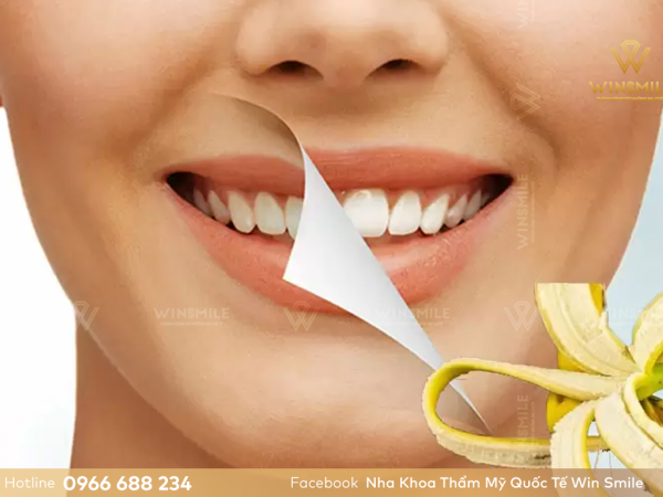 Các phương pháp tẩy trắng răng an toàn, hiệu quả cao