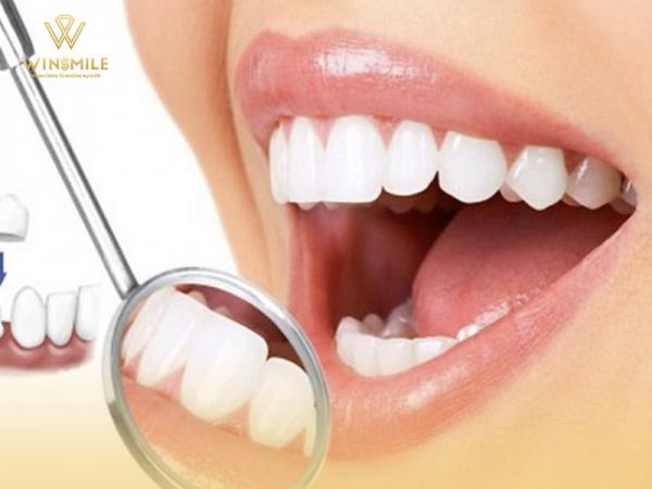 Bọc sứ răng - Tuyệt chiêu giúp hàm răng hoàn hảo nhanh chóng