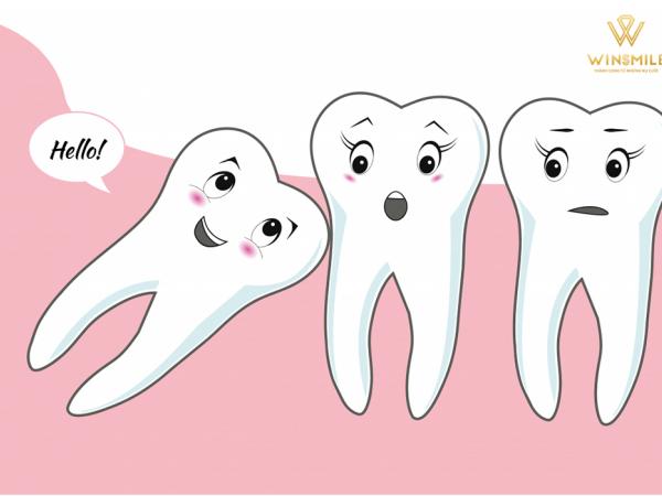 Chia sẻ về các loại răng khôn mà có thể bạn chưa biết