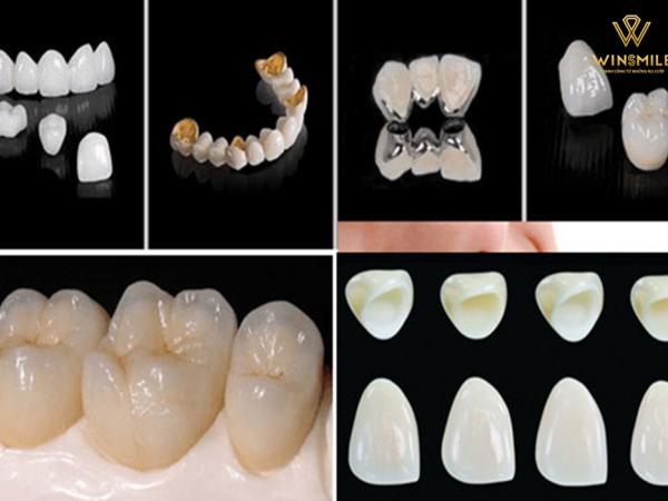 Các loại răng sứ phổ biến và được ưa chuộng nhất hiện nay