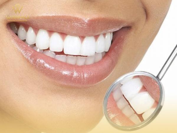 Những điều chuyên gia muốn bạn biết để quyết định có nên dán răng sứ không