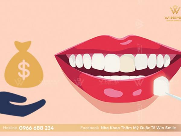 Yếu tố ảnh hưởng đến chi phí dán răng sứ veneer?
