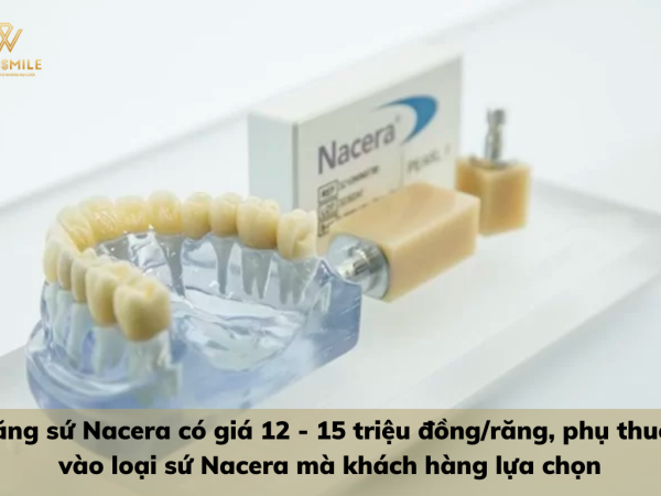 Răng sứ Nacera giá bao nhiêu? So sánh giá bọc sứ Nacera với một số dòng sứ khác