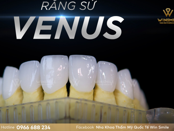 Cập nhật bảng giá răng sứ Venus mới nhất tại Nha khoa Win Smile