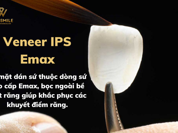 Mặt dán sứ Veneer IPS Emax là gì? Có tốt không? Các loại dán sứ Veneer IPS Emax