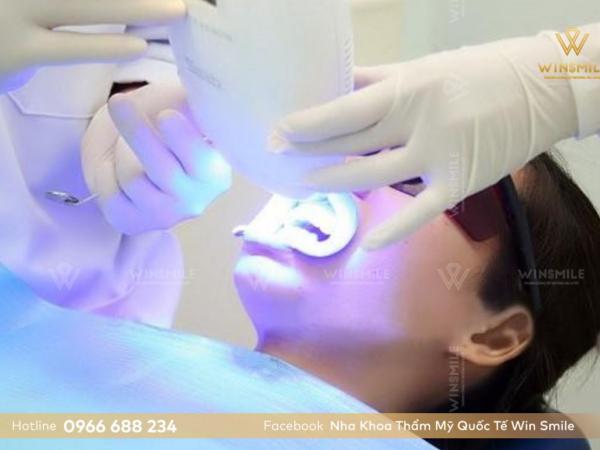 Liệu trình tẩy trắng răng chuẩn y khoa diễn ra như thế nào?