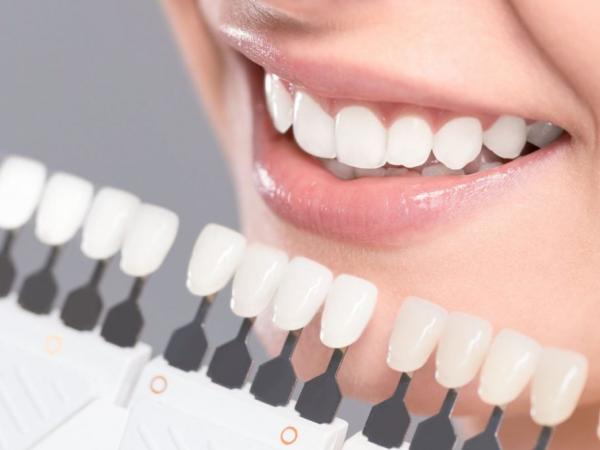 Tẩy trắng răng có hiệu quả hay không? Khi nào cần tẩy trắng răng