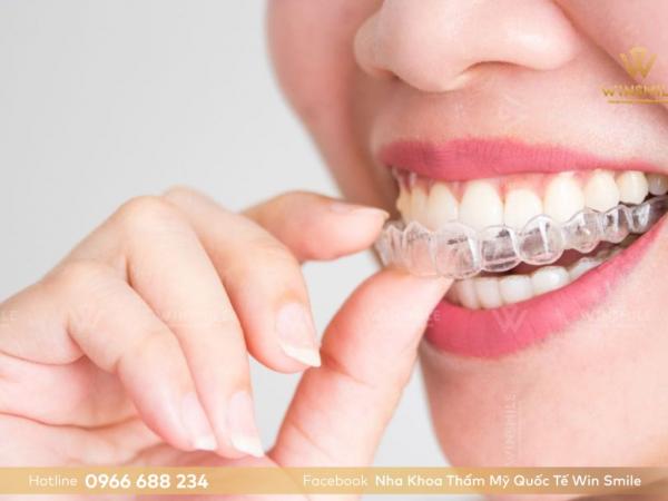 Công nghệ niềng răng Invisalign – Bước đột phá thay đổi thị trường niềng răng