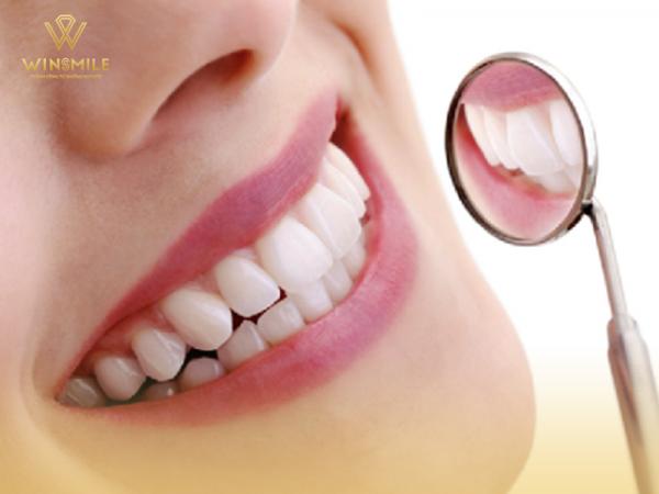 Quy trình bọc răng sứ thẩm mỹ - Các bước quan trọng để kiến tạo hàm răng