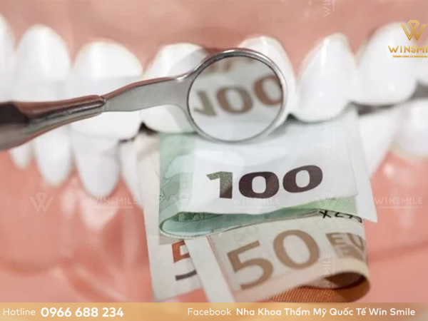 Trồng răng Implant giá bao nhiêu? Cách tính giá làm răng Implant đơn lẻ
