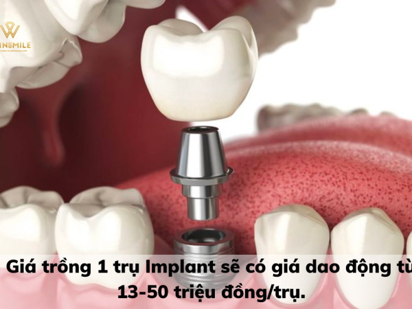 Trồng răng Implant rẻ nhất là bao nhiêu? Cách để trồng răng Implant tiết kiệm chi phí